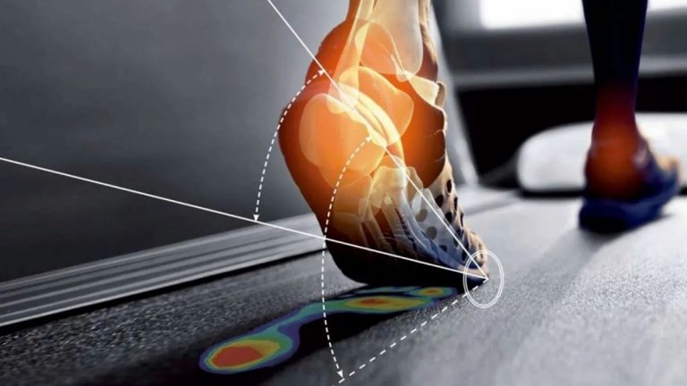 Esame-computerizzato-baropodometrico