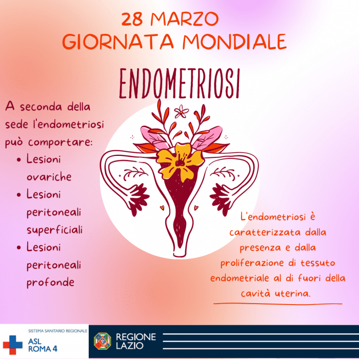 28 marzo 2023: Giornata Mondiale dell'Endometriosi. Il post di ASL ROMA 4