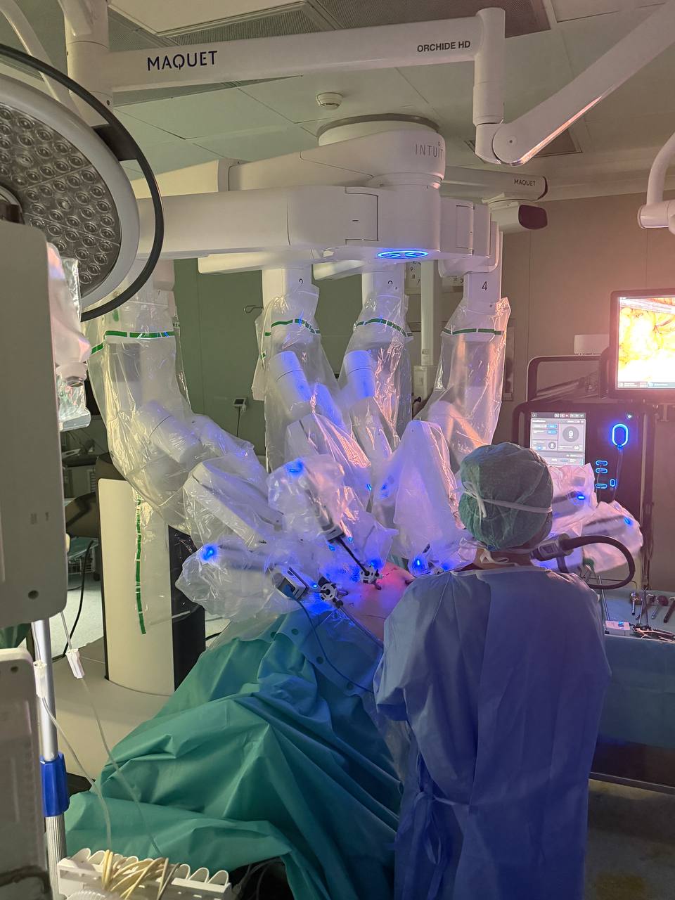 chirurgia robotica